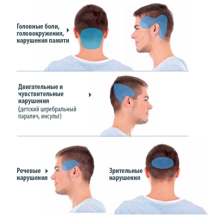 Почему После Секса Кружится Голова