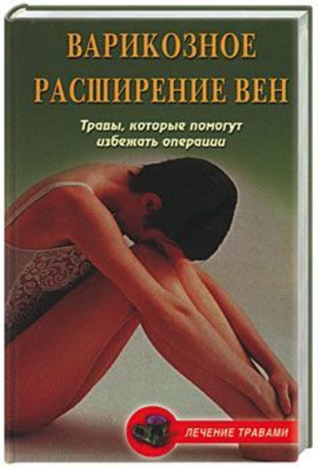 Книга Варикозное Расширение Вен