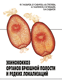Эхинококкоз органов брюшной полости и редких локализаций