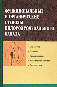 фото Функциональные и органические стенозы пилородуоденального канала