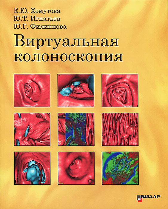 Колоноскопия в диагностическом центре отзывы. Виртуальная колоноскопия. Медицинская литература. Колоноскопия кишечника. Виртуальная колоноскопия отзывы.