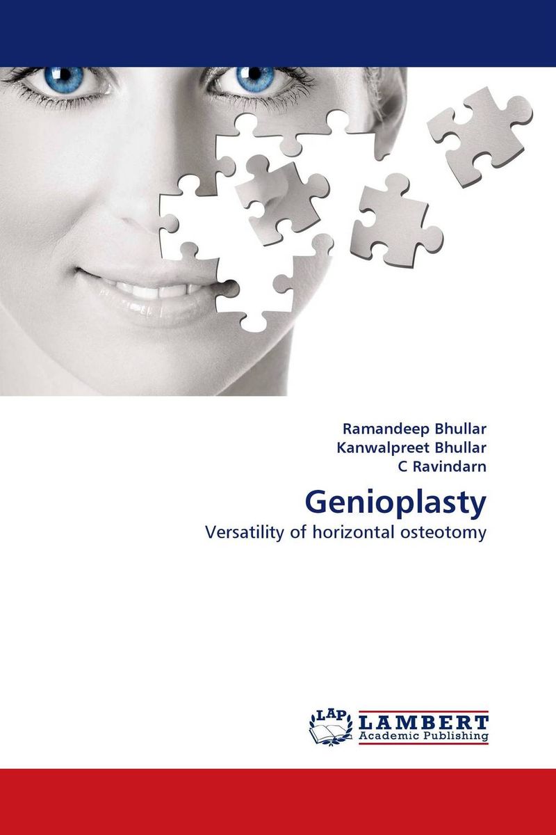 фото Genioplasty Lap lambert academic publishing