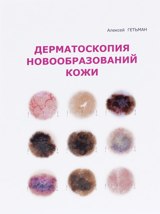 Базалиома кожи как выглядит фото и описание