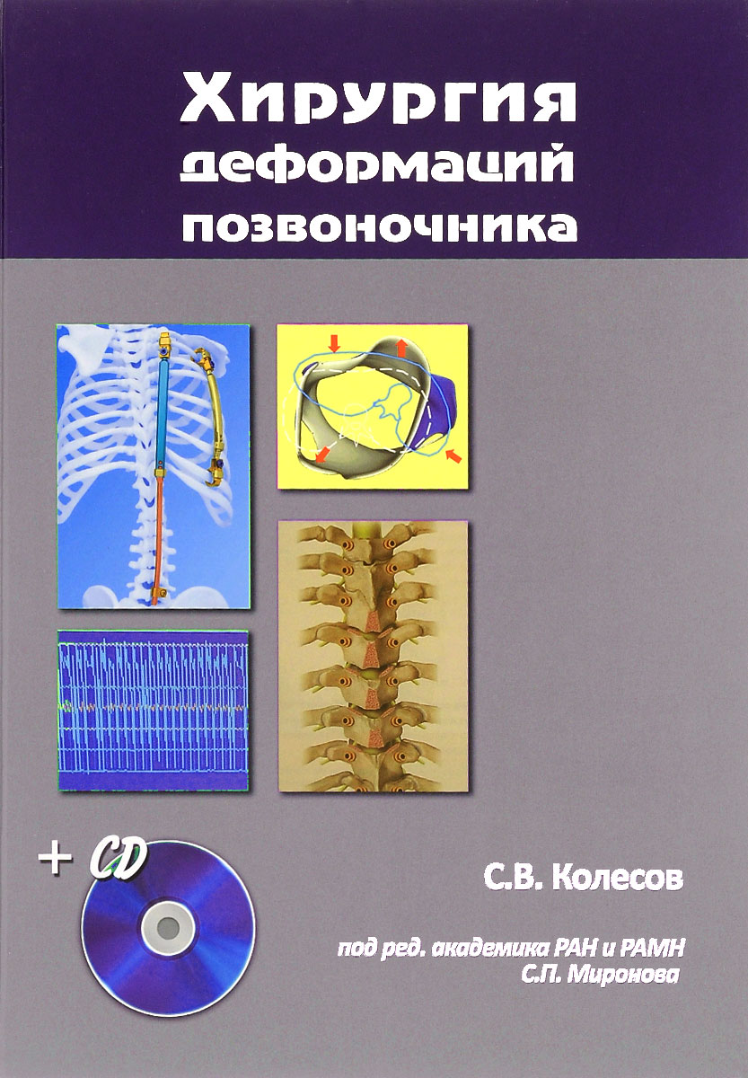 Книга "Хирургия деформаций позвоночника (+ CD)" Колесов Сергей ...