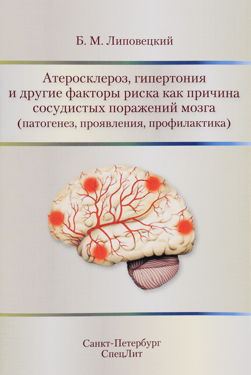 Б. М. Липовецкий Атеросклероз, гипертония и другие факторы риска как причина сосудистых поражений мозга (патогенез, проявления, профилактика) Б. М. Липовецкий Атеросклероз, гипертония и другие факторы риска как причина сосудистых поражений мозга (патогенез, проявления, профилактика)
