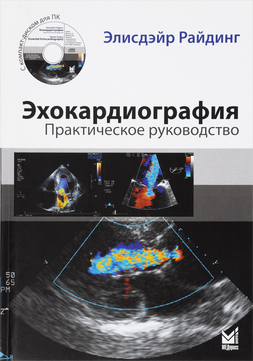 Эхокардиография Цена