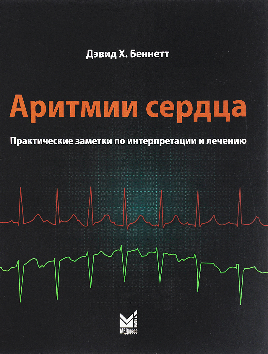 Аритмии сердца. Практические заметки по интерпретации и лечению