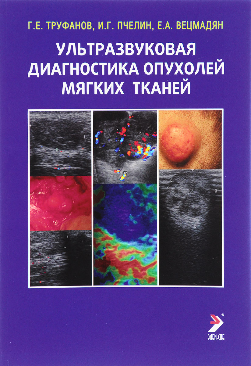 Книга "Ультразвуковая диагностика опухолей мягких тканей" Труфанов ...