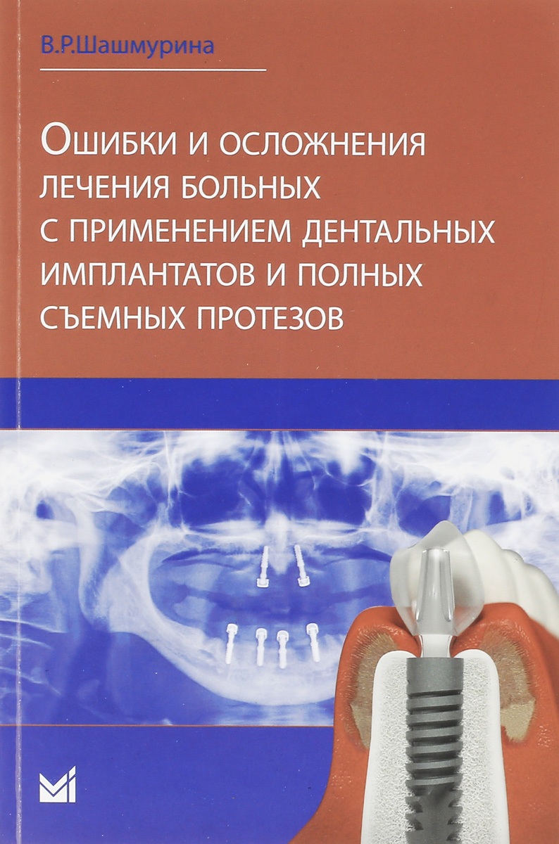 Ошибки и осложнения лечения больных с применением дентальных имплантов и полных съемных протезов | Шашмурина Виктория Рудольфовна