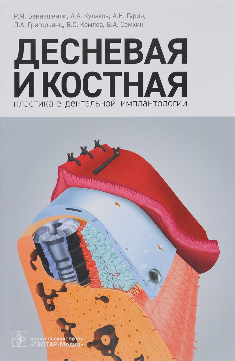 Десневаяикостнаяпластикавдентальнойимплантологии|ГригорьянцЛеонАндроникович,КомлевВладимирСергеевич