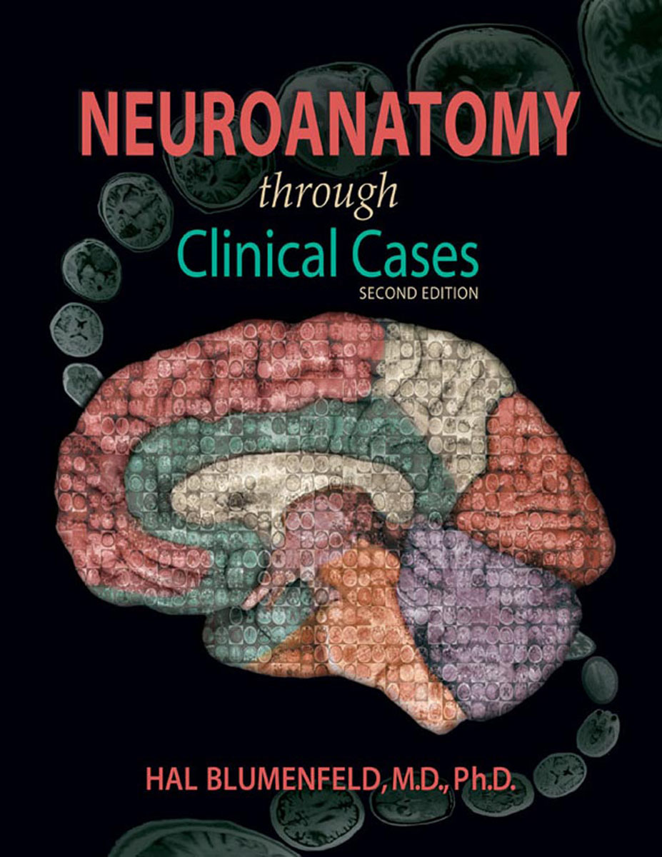 фото Neuroanatomy through Clinical Cases (with ebook) Sinauer associates,oup usa