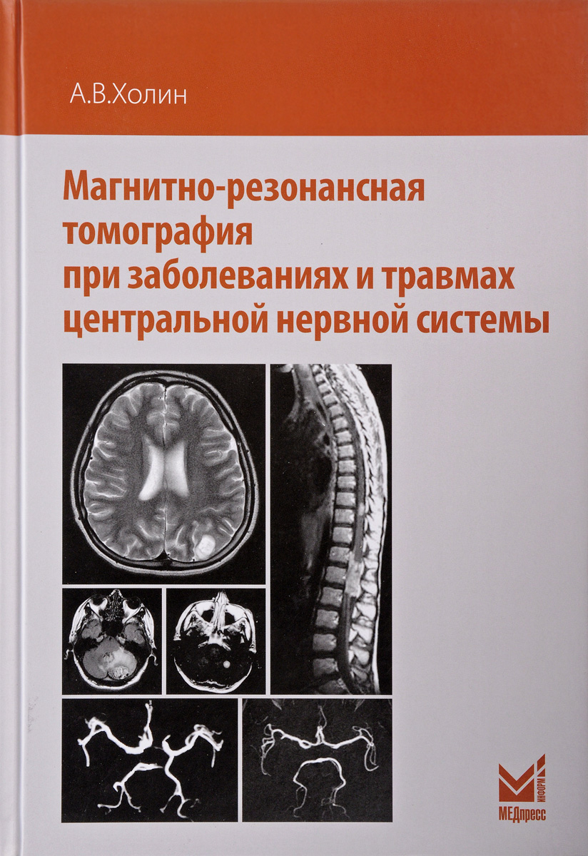 фото Магнитно-резонансная томография при заболеваниях и травмах центральной нервной системы