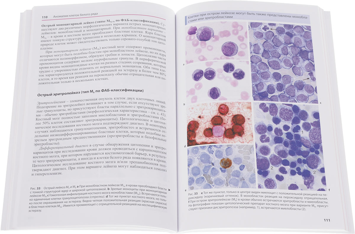 Анализ клетки костного мозга. Гематологический атлас Луговская. Гематология атлас крови. Атлас гематология Хоффбранд. Морфология клеток костного мозга атлас.
