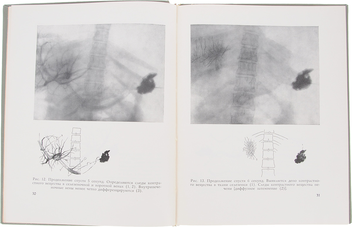 фото Атлас рентгенодиагностики заболеваний сосудов воротной системы