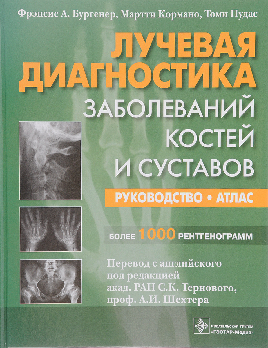 Фрэнсис А. Бургенер, Мартти Кормано, Томи Пудас Лучевая диагностика заболеваний костей и суставов. Руководство. Атлас Фрэнсис А. Бургенер, Мартти Кормано, Томи Пудас Лучевая диагностика заболеваний костей и суставов. Руководство. Атлас