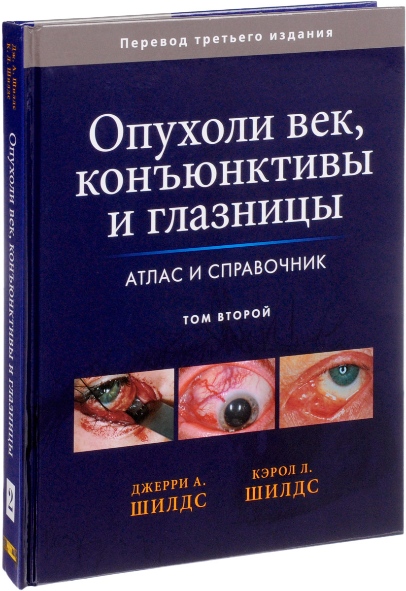 Дж. А. Шилдс, К. Л. Шилдс Опухоли век, конъюнктивы и глазницы. Атлас и справочник. Том 2 Дж. А. Шилдс, К. Л. Шилдс Опухоли век, конъюнктивы и глазницы. Атлас и справочник. Том 2