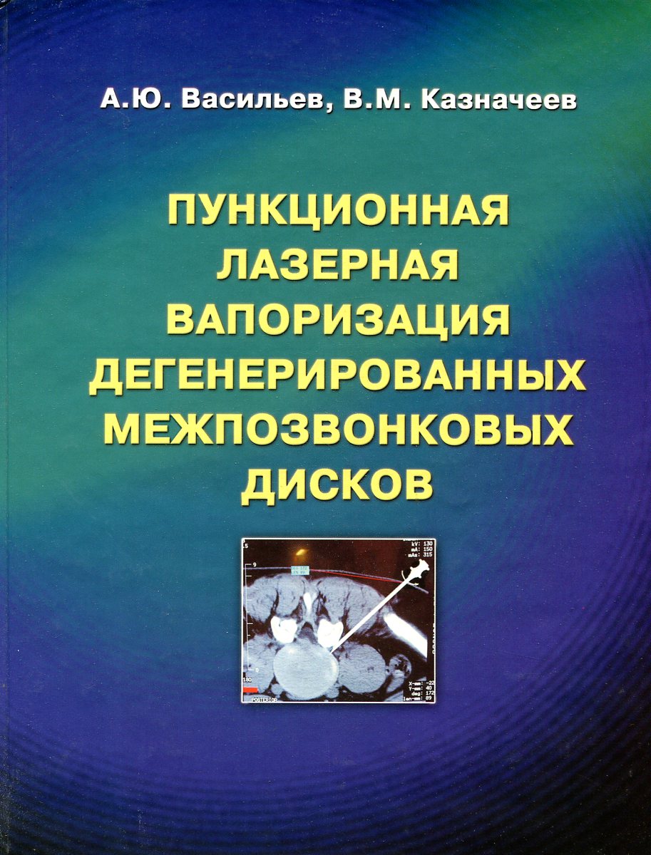 Васильев А. Ю., Казначеев В. М. Пункционная лазерная вапоризация дегенерированных межпозвонковых дисков