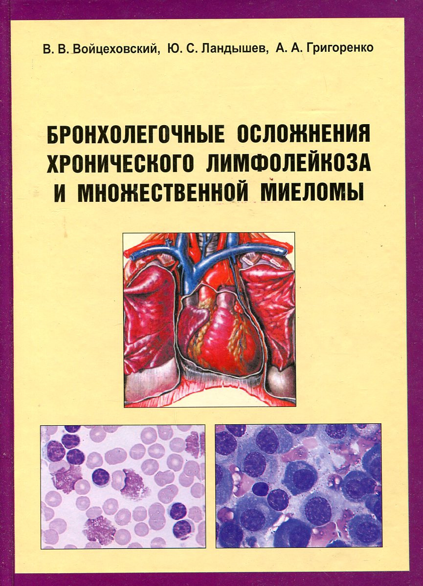 Бронхолегочные осложнения хронического лимфолейкоза и множественной миеломы