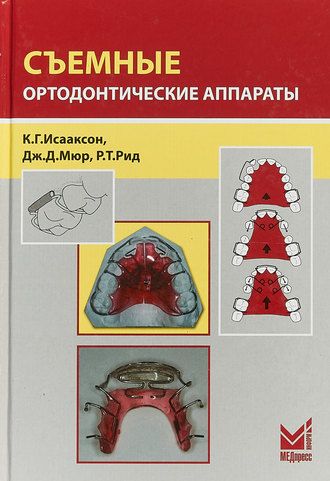 Сьемные ортодонтические аппараты 3е-изд
