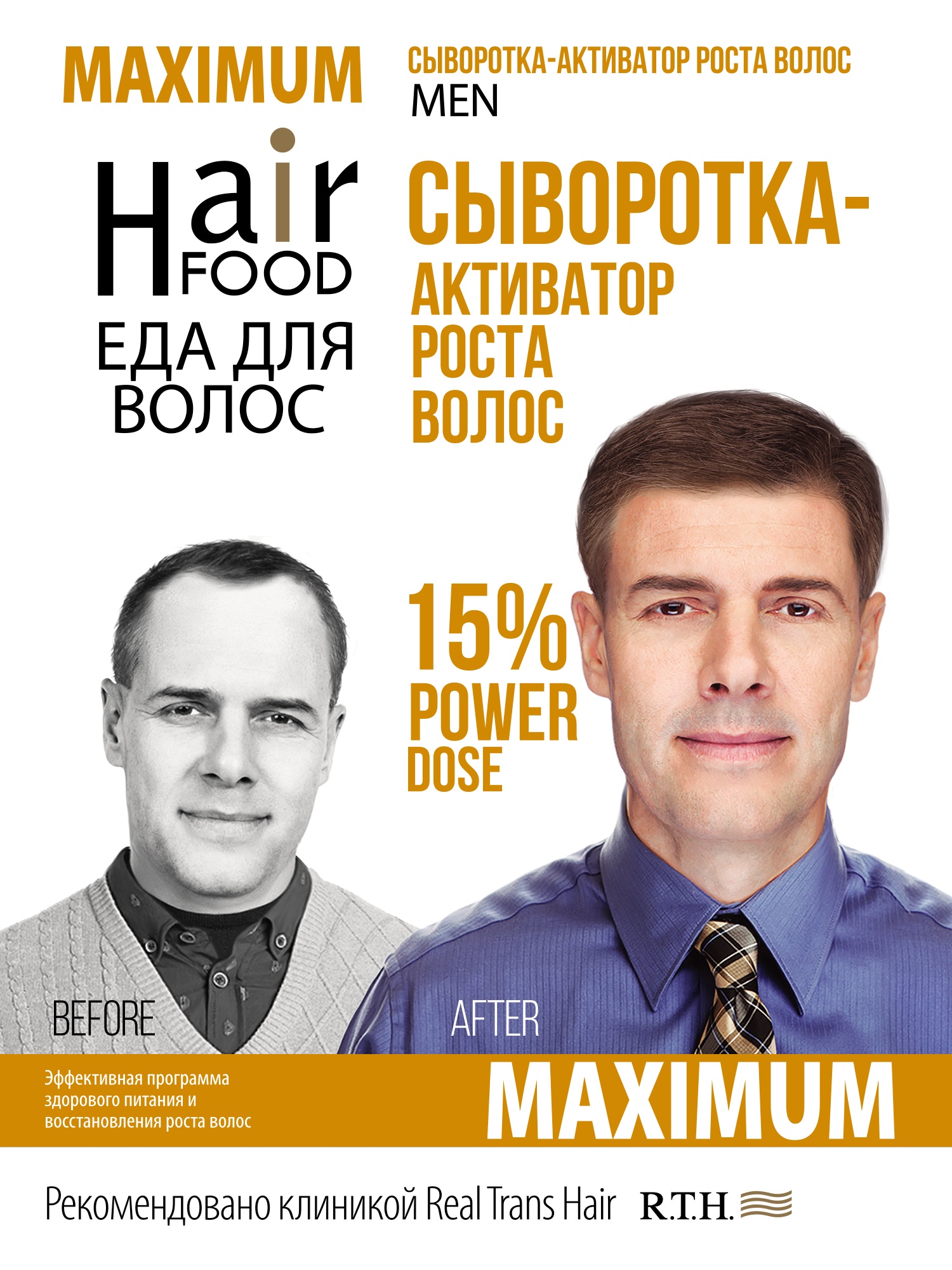 фото Средство для лечения кожи головы и волос HairFood MEN MAXIMUM 15%