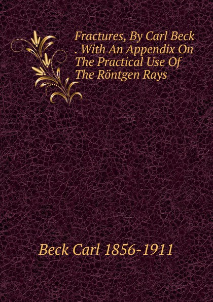 Fractures, By Carl Beck . With An Appendix On The Practical Use Of The Rontgen Rays