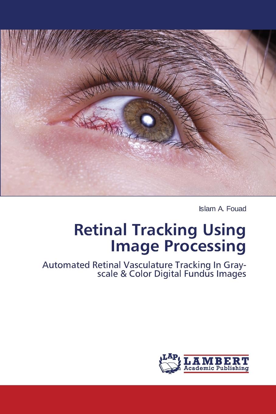 фото Retinal Tracking Using Image Processing