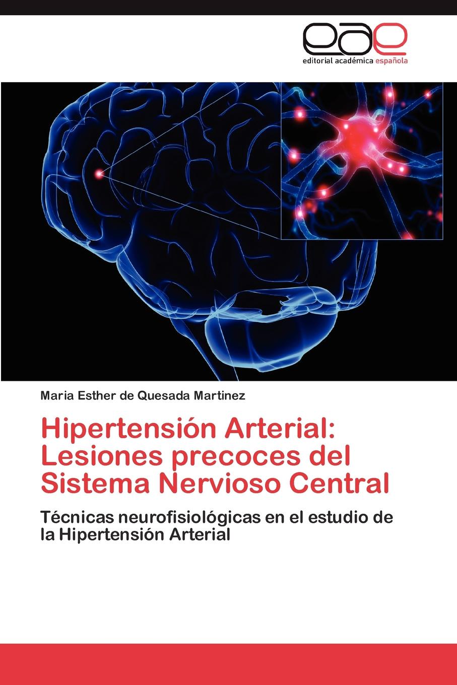 Hipertension Arterial. Lesiones precoces del Sistema Nervioso Central