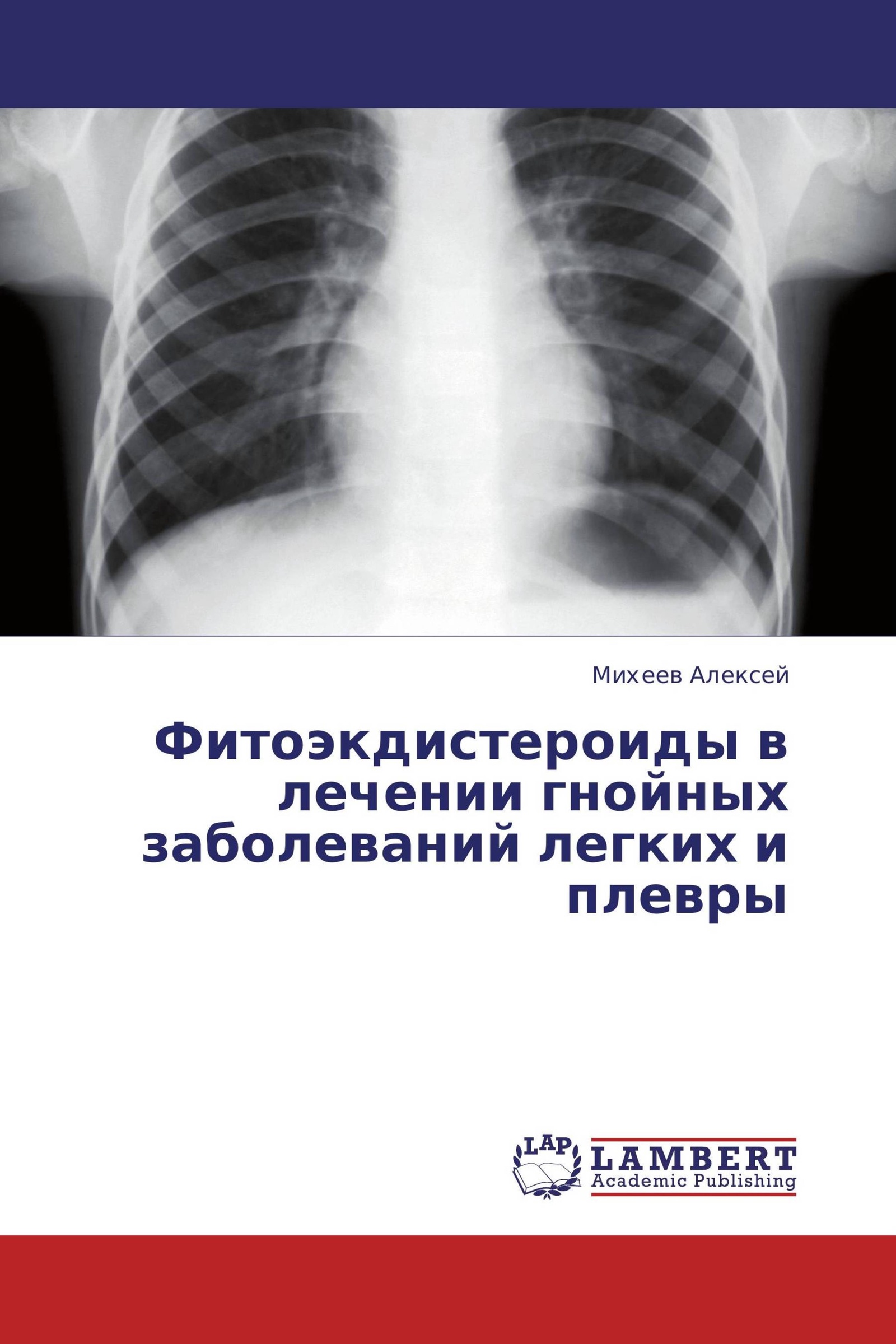 Ссд легких. Нагноительные заболевания легких и плевры. Неопухолевые заболевания легких. Неопухолевые заболевания легких классификация.