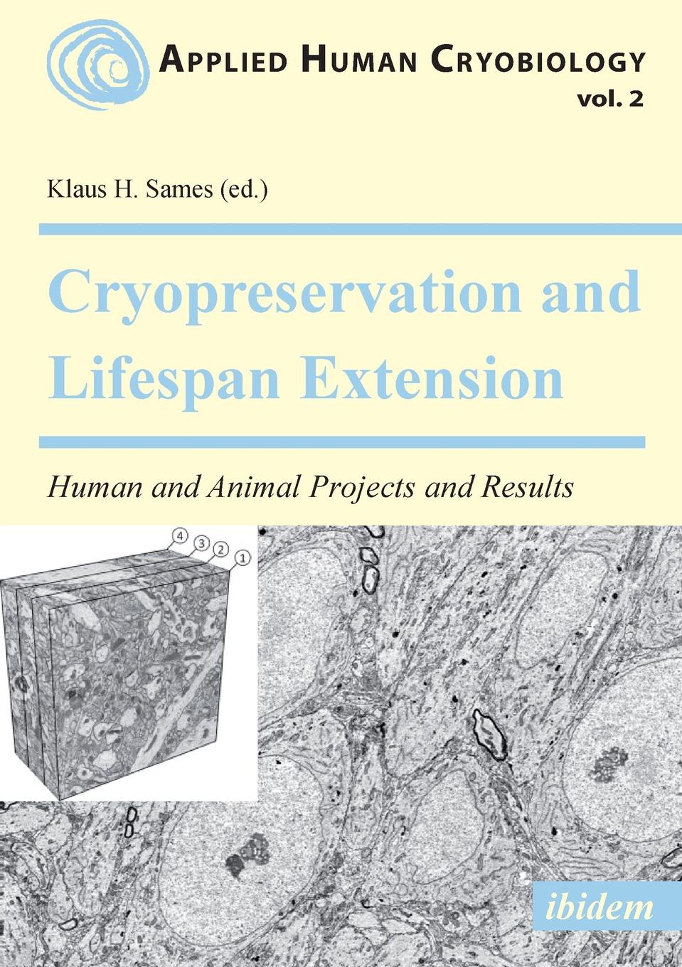 Cryopreservation and Lifespan Extension. Human and Animal Projects and Results