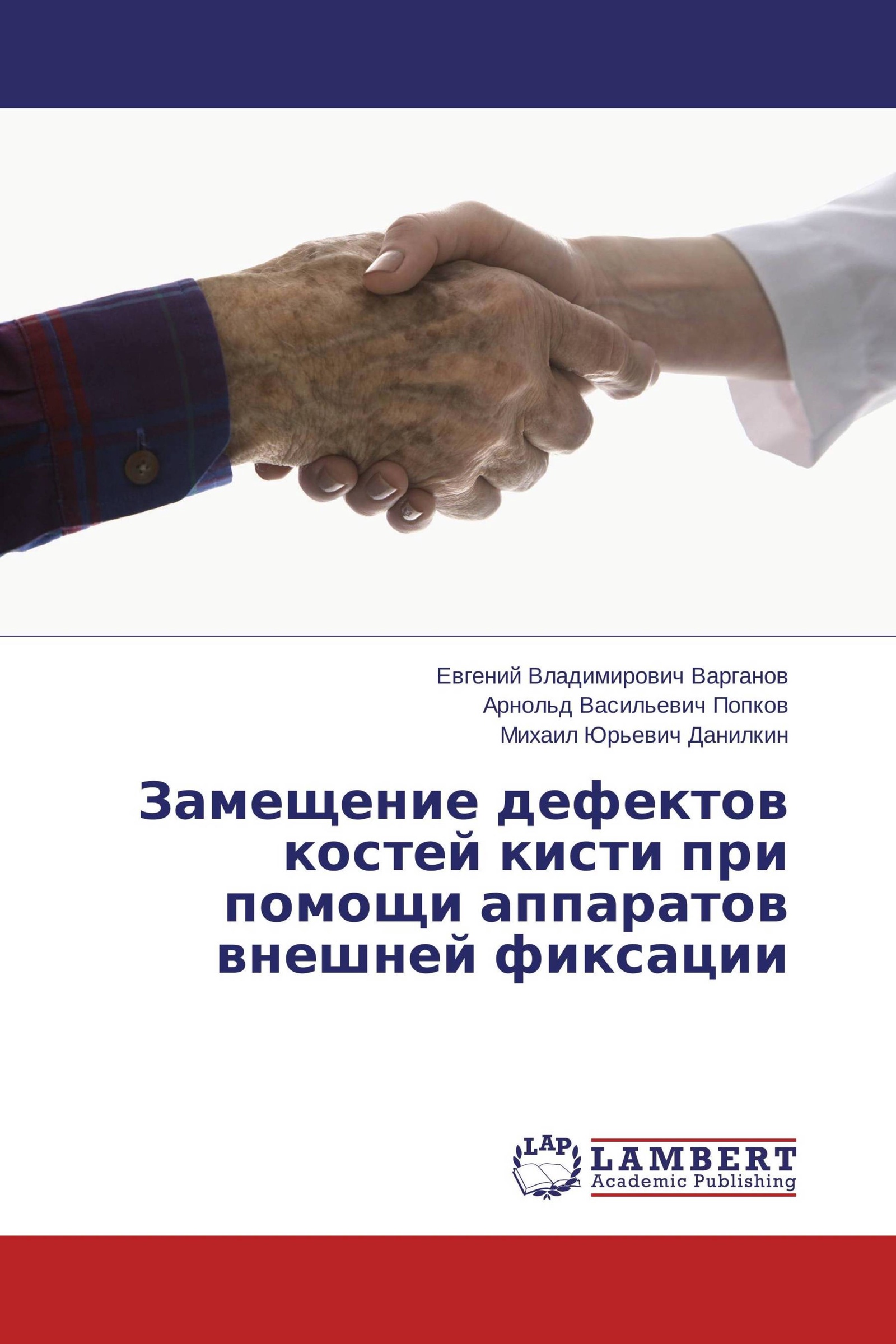 Замещающие товары. Замещение костного дефекта кисти.