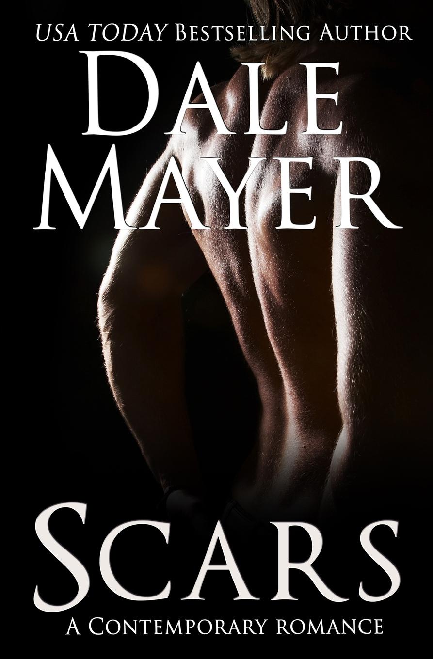 Scars