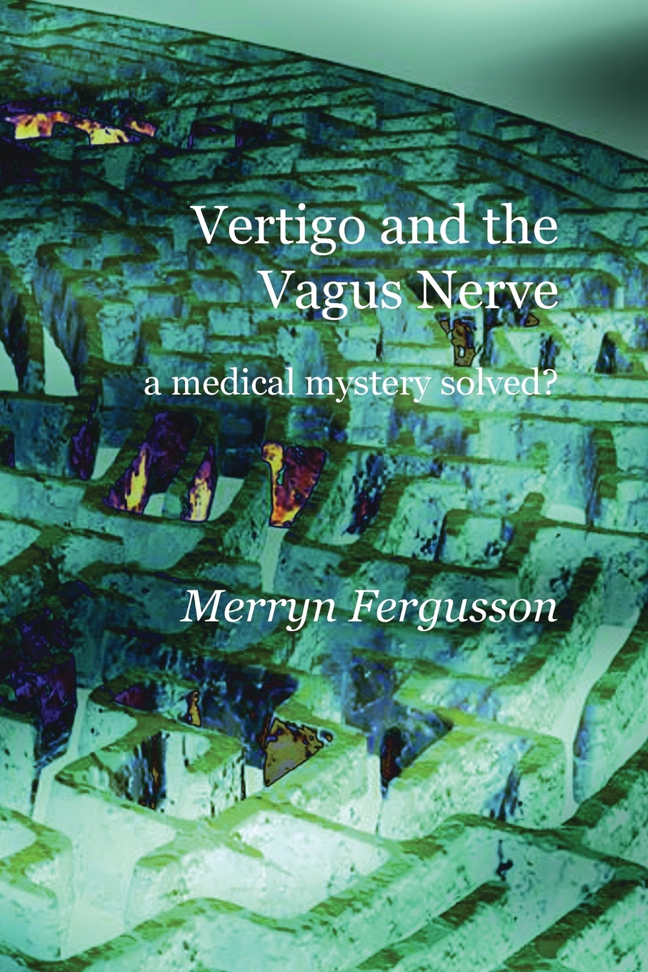 фото Vertigo and the Vagus Nerve - a medical mystery solved?