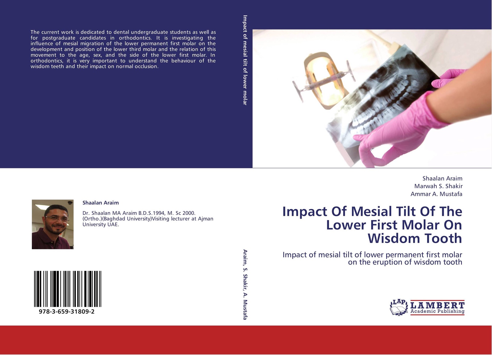 Shaalan Araim,Marwah S. Shakir and Ammar A. Mustafa Impact Of Mesial Tilt Of The Lower First Molar On Wisdom Tooth Shaalan Araim,Marwah S. Shakir and Ammar A. Mustafa Impact Of Mesial Tilt Of The Lower First Molar On Wisdom Tooth