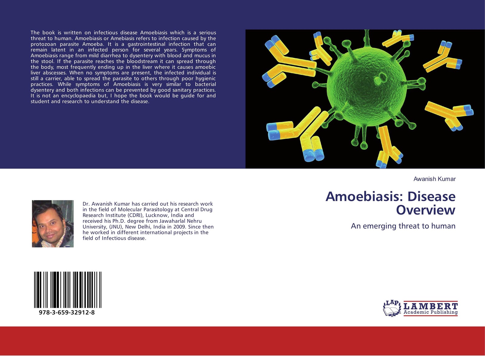 Proper solution. Antibody Production. Anti cytomegalovirus Immunoglobulin.