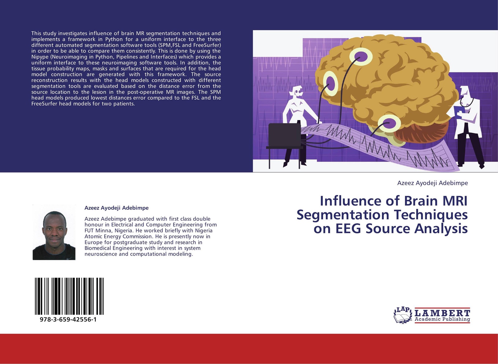 The technique being developed. Обложка монографии. psychiatry research journal. computer-brain interface invasive non invasive. edmund s. the neuroscience of clinical psychiatry.