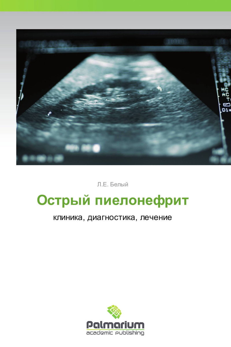 Острый пиелонефрит Острый пиелонефрит