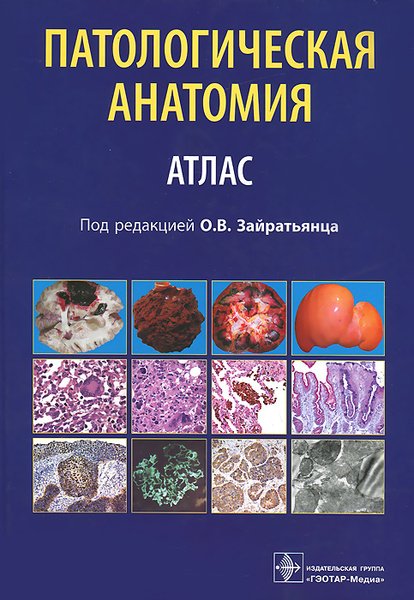 Патологическая анатомия : атлас : учеб. пособие для …