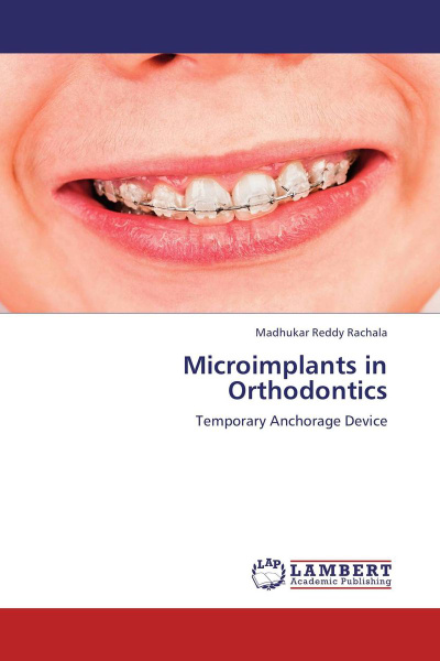 Характеристики Microimplants in Orthodontics подробное описание товара ...