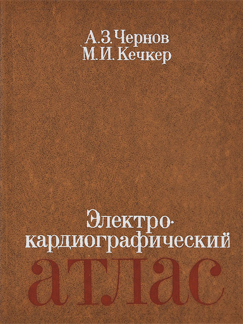 Кечкер атлас по электрокардиографии