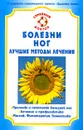 Болезни ног. Лучшие методы лечения - О. Н. Родионова