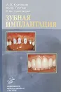 Зубная имплантация - А. А. Кулаков, Ф. Ф. Лосев, Р. Ш. Гветадзе