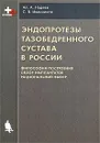 Эндопротезы тазобедренного сустава в России. Философия построения, обзор имплантатов, рациональный выбор - Ал. А. Надеев, С. В. Иванников