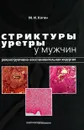 Стриктуры уретры у мужчин. Реконструктивно-восстановительная хирургия - М. И. Коган