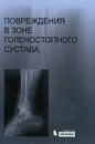 Повреждения в зоне голеностопного сустава (+ CD-ROM) - Шестерня Н.А. (Под ред. академика РАН и