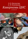 Каверномы ЦНС - Белоусова О. Б., Коновалов А. Н., Окишев Д. Н.