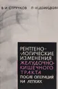 Рентгенологические изменения желудочно-кишечного тракта после радикальных операций на легких - В.И. Стручков