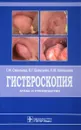 Гистероскопия. Атлас и руководство - Г. М. Савельева, В. Г. Бреусенко, Л. М. Каппушева