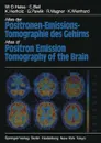 Atlas der Positronen-Emissions-Tomographie des Gehirns / Atlas of Positron Emission Tomography of the Brain - W.-D. Heiss