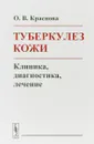 Туберкулез кожи. Клиника, диагностика, лечение - О. В. Краснова