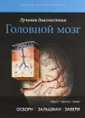 Лучевая диагностика. Головной мозг - Зальцман Карен Л., Осборн Анна Г.